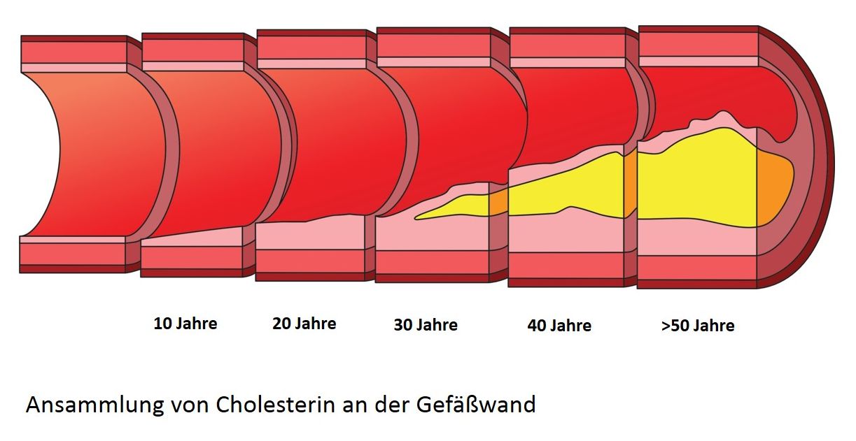 Grafik Cholesterin